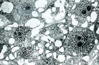 Electron Micrograph of Wheat Leaf