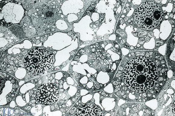 Electron Micrograph of Wheat Leaf