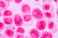 Onion Root Mitosis